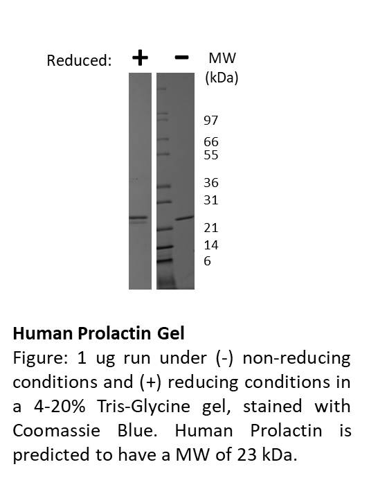 Human Prolactin