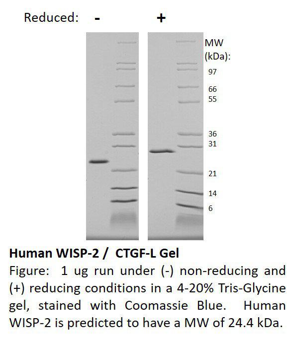 Human WNT1-inducible-signaling pathway protein-2