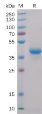 Recombinant human BCMA protein with C-terminal human Fc and 6Ã—His tag