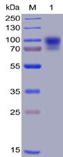 Recombinant human SIRP alpha protein with C-terminal human Fc and 6Ã—His tag