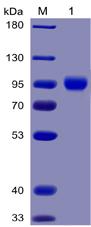 Recombinant human CD155 protein with C-terminal mouse Fc and 6Ã—His tag