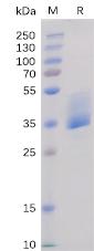 Recombinant Human BAFF-R protein with C-terminal mouse Fc