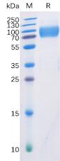 Recombinant human DNAM-1 protein with C-terminal mouse Fc and 6Ã—His tag