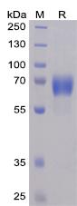 Recombinant human NTB-A protein with C-terminal mouse Fc and 6Ã—His tag