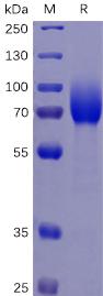 Recombinant human CSF1R protein with C-terminal 6Ã—His tag