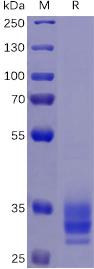 Recombinant human EPCAM protein with C-terminal 6Ã—His tag