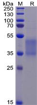 Recombinant human FCGR3A protein(F176V) with C-terminal 6Ã—His tag