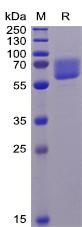 Recombinant human AXL protein with C-terminal 6Ã—His tag