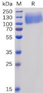 Recombinant human CEACAM5 protein with C-terminal 6Ã—His tag