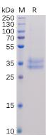 Recombinant human IL2RB protein with C-terminal 6Ã—His Fc tag