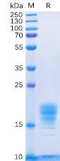 Recombinant Human IL5 protein with C-terminal 6Ã—His tag