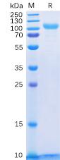 Recombinant Human HER3 protein with C-terminal 6Ã—His tag