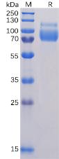 Recombinant Human SIGLEC10 protein with C-terminal 6Ã—His tag