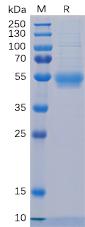 Recombinant human L5RA protein with C-terminal 6Ã—His tag