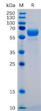 Recombinant human SIGLEC15 protein with C-terminal mouse Fc and 6Ã—His tag