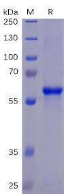 Recombinant SARS-CoV-2 (2019-nCoV) S protein RBD with C-terminal mouse Fc and 6Ã—His tag