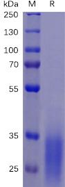 Recombinant human PD-1 protein with C-terminal 6Ã—His tag