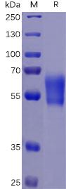 Recombinant human PD-1 protein with C-terminal human Fc and 6Ã—His tag