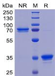 Recombinant human TweakR protein with C-terminal mouse Fc tag