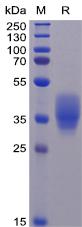 Recombinant human CD200 protein with C-terminal 6His tag