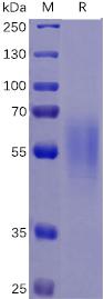 Recombinant human IL17RA protein with C-terminal 6Ã—His tag