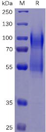 Recombinant human CD34 protein with C-terminal 6Ã—His tag