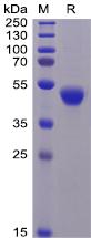 Recombinant human CD5 protein with C-terminal 6Ã—His tag