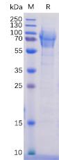 Recombinant Human CD162 protein with C-terminal 6Ã—His tag