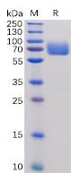 Recombinant human B7-1 protein with C-terminal human Fc tag