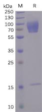 Recombinant human CD30 protein with C-terminal 6Ã—His tag