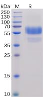 Recombinant human CD70 protein with C-terminal human Fc and 6Ã—His tag