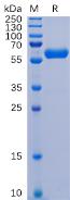 SARS-CoV-2 (2019-nCoV) S protein RBD, hFc Tag