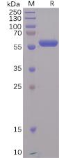 Recombinant SARS-CoV-2 (2019-nCoV) S protein RBD with C-terminal mouse Fc tag