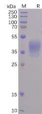 SARS-CoV-2 Spike-Membrane Recombinant Fusion Protein, His Tag