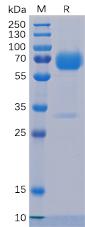 Recombinant human Trop2 protein with C-terminal mouse Fc and 6Ã—His tag