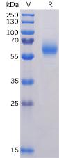 Recombinant Nucleocapsid protein with C-terminal 6Ã—His tag