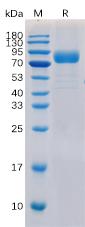 Recombinant human CD19 Protein with C-Human Fc and 6Ã—His tag