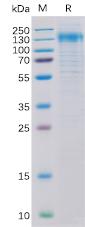 Recombinant human Her2 Protein with C-6Ã—His tag