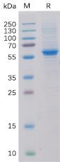 Recombinant human ROR2 Protein with C-6Ã—His tag