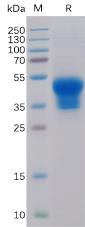 Recombinant human IL2RA Protein with C-6Ã—His tag