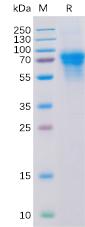 Recombinant human CD46 Protein with C-6Ã—His tag