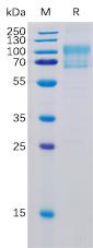 Recombinant Human B7-1 Protein with C-terminal Mouse Fc and 6Ã—His tag