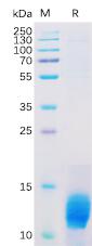 Recombinant Human MUC1 Protein with C-terminal 6Ã—His tag