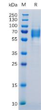 Recombinant Human IL6R Protein with C-terminal 6Ã—His tag