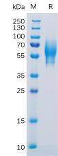 Recombinant Human 5T4 Protein with C-terminal 6Ã—His tag