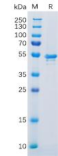 Recombinant Human CA9 Protein with C-terminal 6Ã—His tag