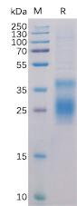 Recombinant Human HVEM Protein with C-terminal 6Ã—His tag