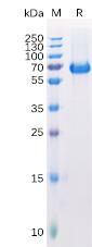 Recombinant Human EPHA2 Protein with C-terminal 6Ã—His tag