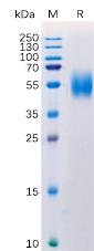 Recombinant Human MICA Protein with C-terminal 6Ã—His tag