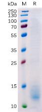 Recombinant Human BCMA Protein with C-terminal 6Ã—His tag